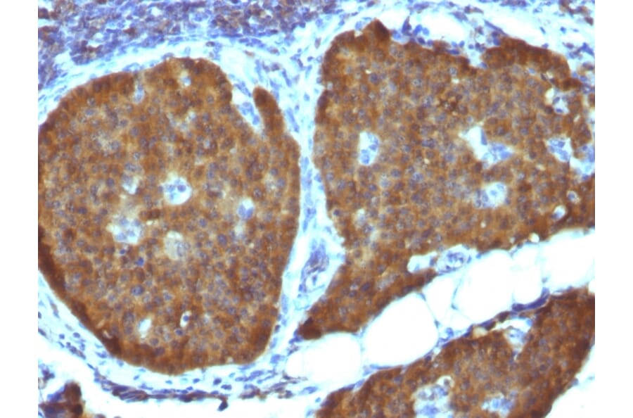 Immunohistochemistry - Anti-Neuron Specific Enolase Antibody [ENO2/1462] - BSA and Azide free (A251618) - Antibodies.com