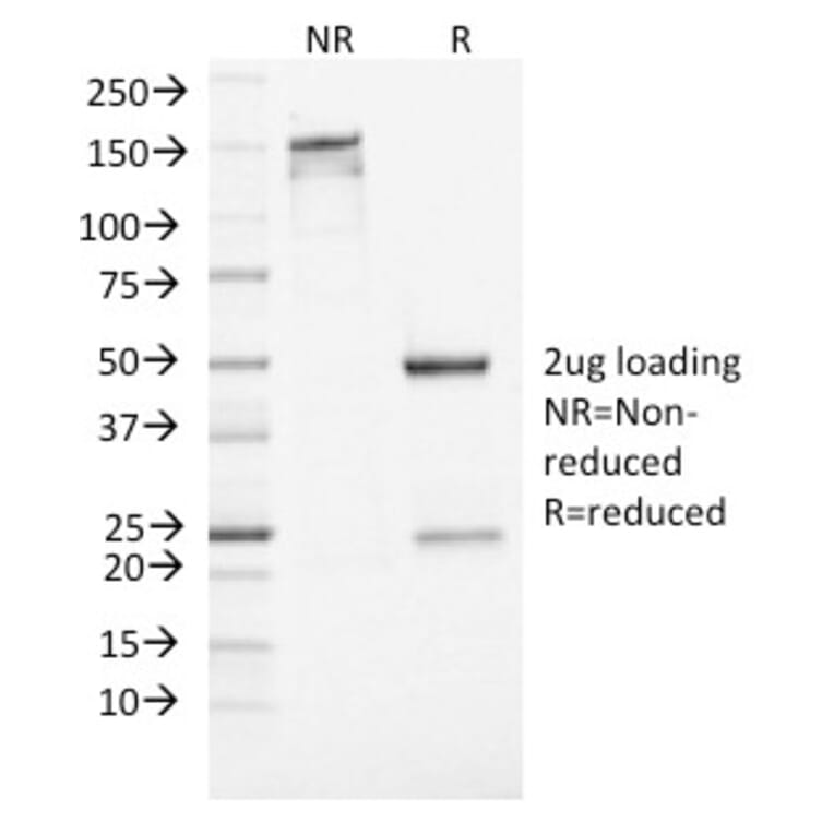 SDS-PAGE - Anti-Neuron Specific Enolase Antibody [ENO2/1462] - BSA and Azide free (A251618) - Antibodies.com