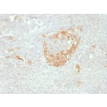 Immunohistochemistry - Anti-Neuron Specific Enolase Antibody [NSE-P2] - BSA and Azide free (A251618) - Antibodies.com