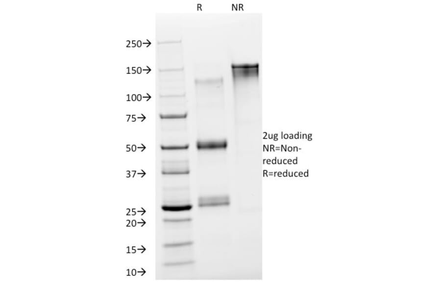 SDS-PAGE - Anti-Neuron Specific Enolase Antibody [NSE-P2] - BSA and Azide free (A251619) - Antibodies.com
