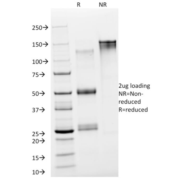 SDS-PAGE - Anti-Neuron Specific Enolase Antibody [NSE-P2] - BSA and Azide free (A251619) - Antibodies.com
