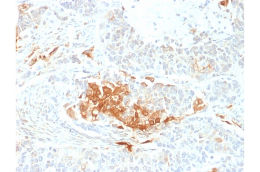 Immunohistochemistry - Anti-Neuron Specific Enolase Antibody [ENO2/2706] - BSA and Azide free (A251619) - Antibodies.com