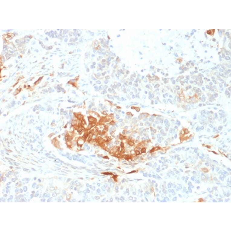 Immunohistochemistry - Anti-Neuron Specific Enolase Antibody [ENO2/2706] - BSA and Azide free (A251619) - Antibodies.com