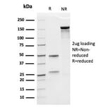 SDS-PAGE - Anti-EPO Antibody [rEPO/1367] - BSA and Azide free (A251623) - Antibodies.com