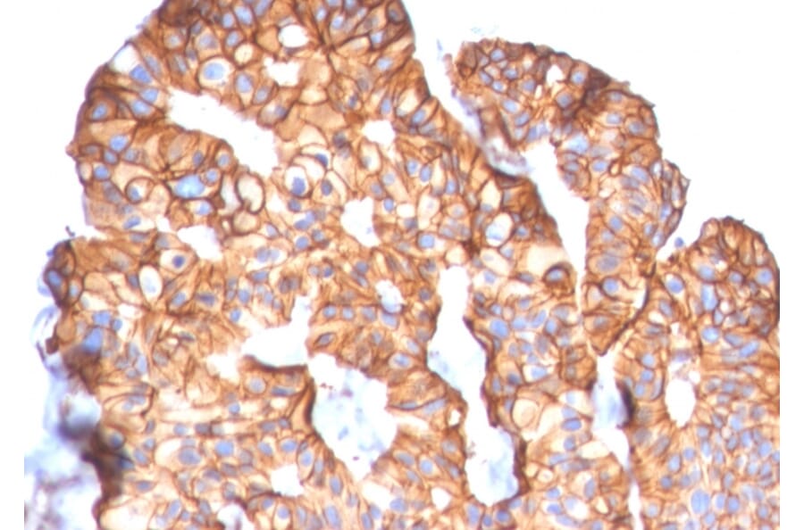 Immunohistochemistry - Anti-HER2 Antibody [ERBB2/2452] - BSA and Azide free (A251625) - Antibodies.com
