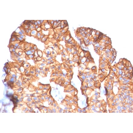 Immunohistochemistry - Anti-HER2 Antibody [ERBB2/2452] - BSA and Azide free (A251625) - Antibodies.com