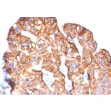 Immunohistochemistry - Anti-HER2 Antibody [ERBB2/2452] - BSA and Azide free (A251625) - Antibodies.com
