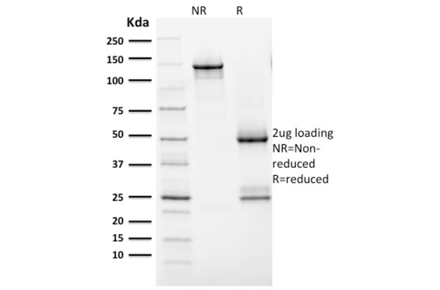 SDS-PAGE - Anti-HER2 Antibody [ERBB2/2452] - BSA and Azide free (A251625) - Antibodies.com