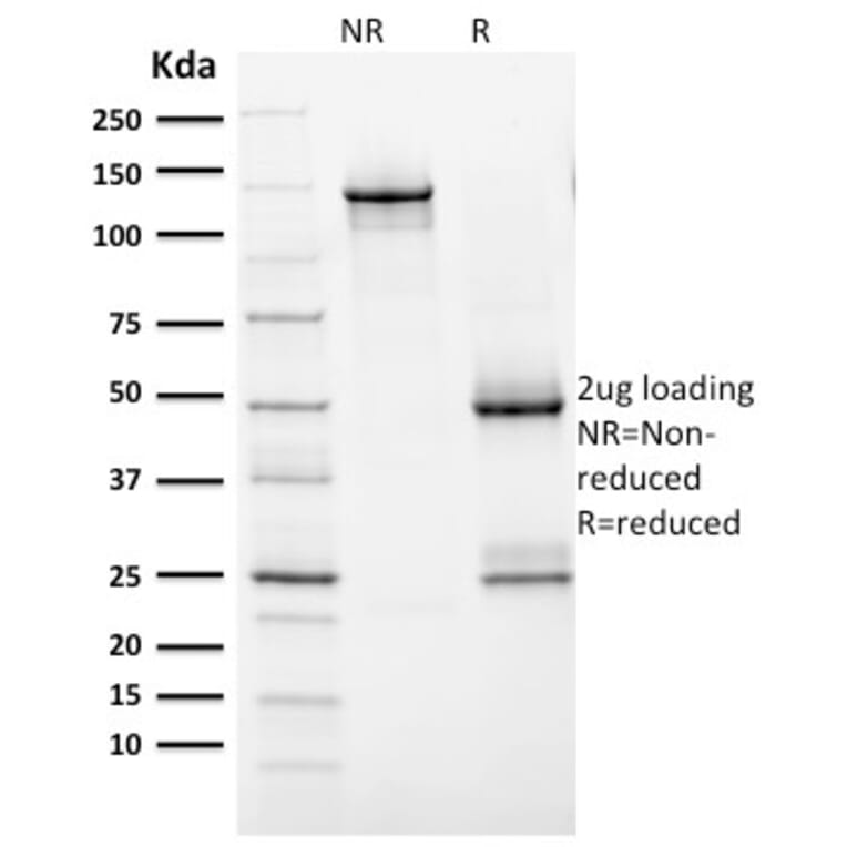 SDS-PAGE - Anti-HER2 Antibody [ERBB2/2452] - BSA and Azide free (A251625) - Antibodies.com