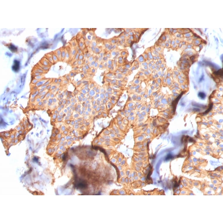 Immunohistochemistry - Anti-HER2 Antibody [SPM172] - BSA and Azide free (A248444) - Antibodies.com