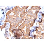 Immunohistochemistry - Anti-HER2 Antibody [SPM172] - BSA and Azide free (A248444) - Antibodies.com