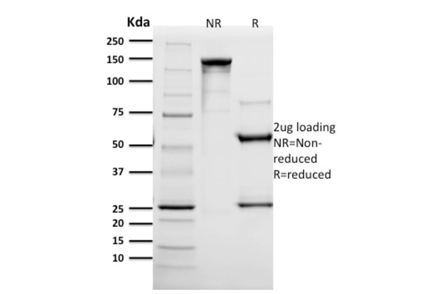 SDS-PAGE - Anti-HER2 Antibody [SPM172] - BSA and Azide free (A248444) - Antibodies.com