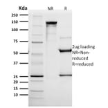 SDS-PAGE - Anti-HER2 Antibody [SPM172] - BSA and Azide free (A248444) - Antibodies.com