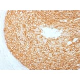 Immunohistochemistry - Anti-HER2 Antibody [ERBB2/2453] - BSA and Azide free (A251627) - Antibodies.com