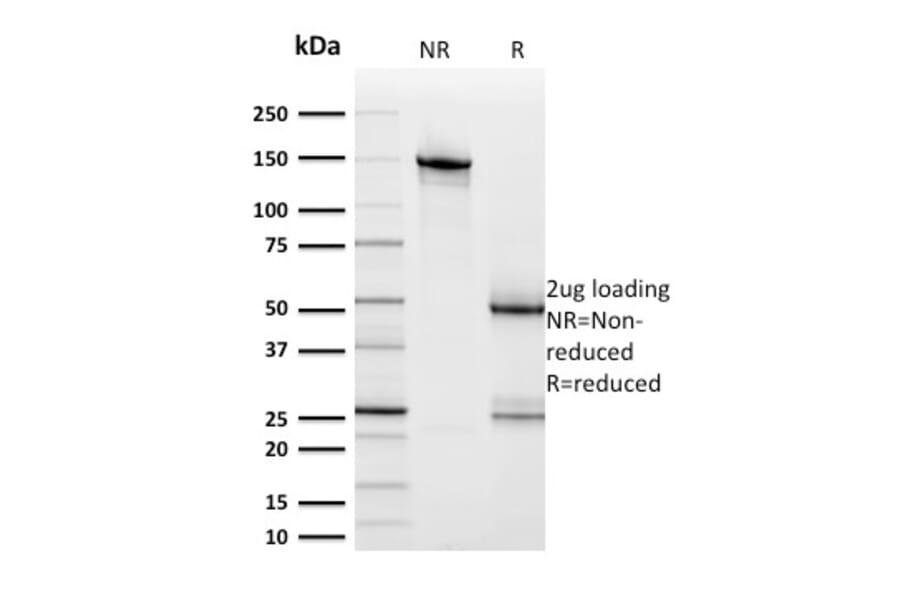 SDS-PAGE - Anti-HER2 Antibody [ERBB2/2453] - BSA and Azide free (A251627) - Antibodies.com