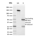 SDS-PAGE - Anti-HER2 Antibody [ERBB2/2453] - BSA and Azide free (A251627) - Antibodies.com