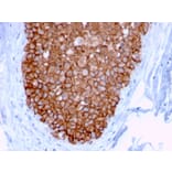 Immunohistochemistry - Anti-HER2 Antibody [ERBB2/3078] - BSA and Azide free (A251628) - Antibodies.com