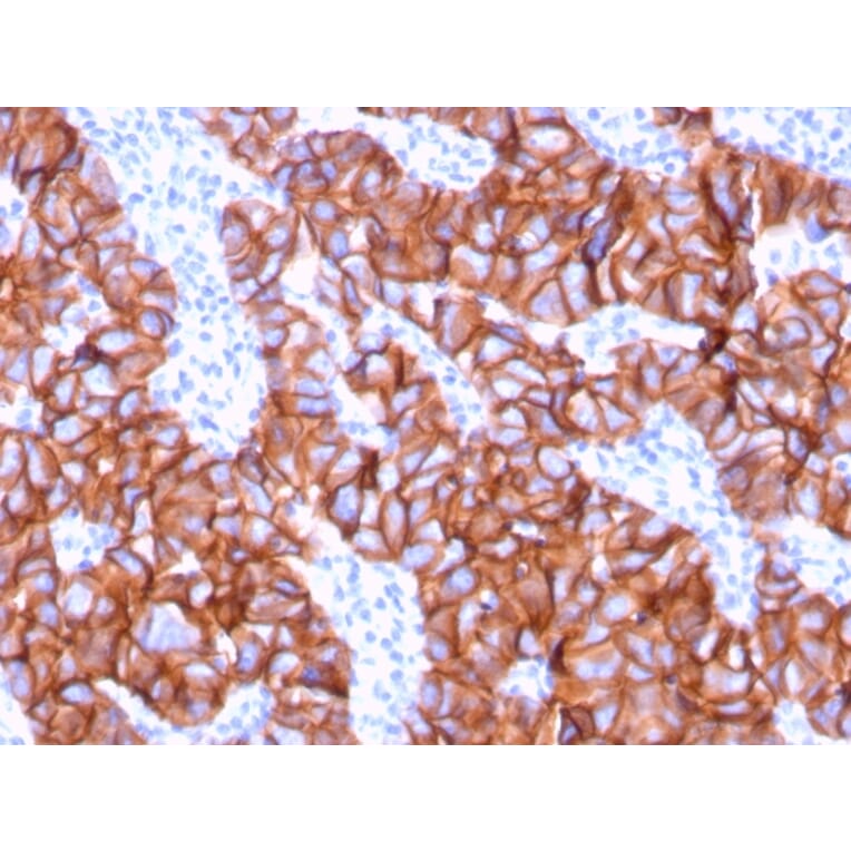 Immunohistochemistry - Anti-HER2 Antibody [ERBB2/3078] - BSA and Azide free (A251628) - Antibodies.com