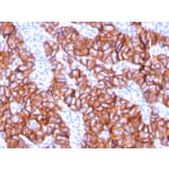 Immunohistochemistry - Anti-HER2 Antibody [ERBB2/3078] - BSA and Azide free (A251628) - Antibodies.com