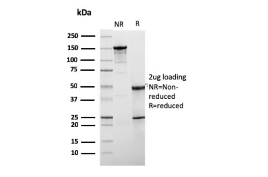 SDS-PAGE - Anti-HER2 Antibody [ERBB2/3078] - BSA and Azide free (A251628) - Antibodies.com