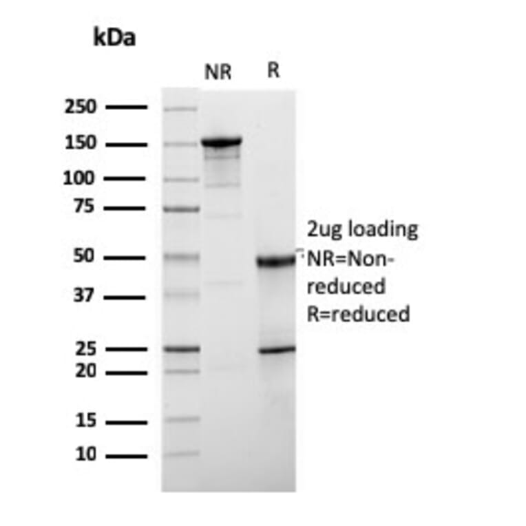 SDS-PAGE - Anti-HER2 Antibody [ERBB2/3078] - BSA and Azide free (A251628) - Antibodies.com