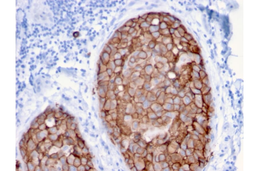 Immunohistochemistry - Anti-HER2 Antibody [ERBB2/3079] - BSA and Azide free (A251629) - Antibodies.com