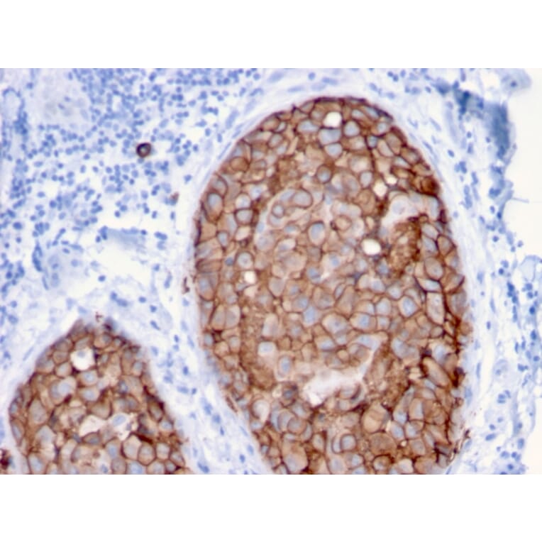 Immunohistochemistry - Anti-HER2 Antibody [ERBB2/3079] - BSA and Azide free (A251629) - Antibodies.com