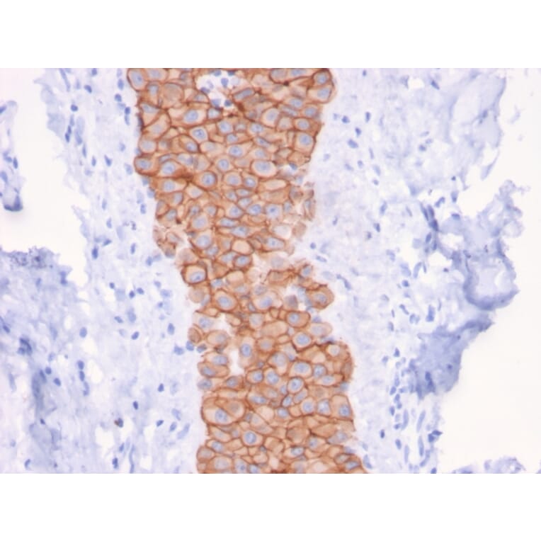 Immunohistochemistry - Anti-HER2 Antibody [ERBB2/3079] - BSA and Azide free (A251629) - Antibodies.com