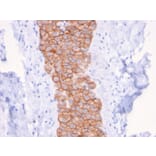 Immunohistochemistry - Anti-HER2 Antibody [ERBB2/3079] - BSA and Azide free (A251629) - Antibodies.com