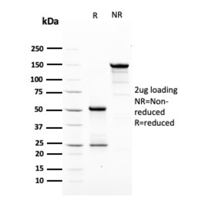 SDS-PAGE - Anti-HER2 Antibody [ERBB2/3079] - BSA and Azide free (A251629) - Antibodies.com