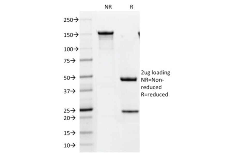 SDS-PAGE - Anti-HER2 Antibody [HRB2/451] - BSA and Azide free (A251630) - Antibodies.com