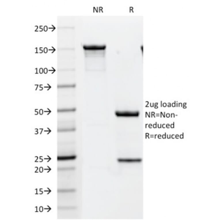 SDS-PAGE - Anti-HER2 Antibody [HRB2/451] - BSA and Azide free (A251630) - Antibodies.com