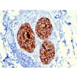 Immunohistochemistry - Anti-HER2 Antibody [ERBB2/3080] - BSA and Azide free (A251631) - Antibodies.com