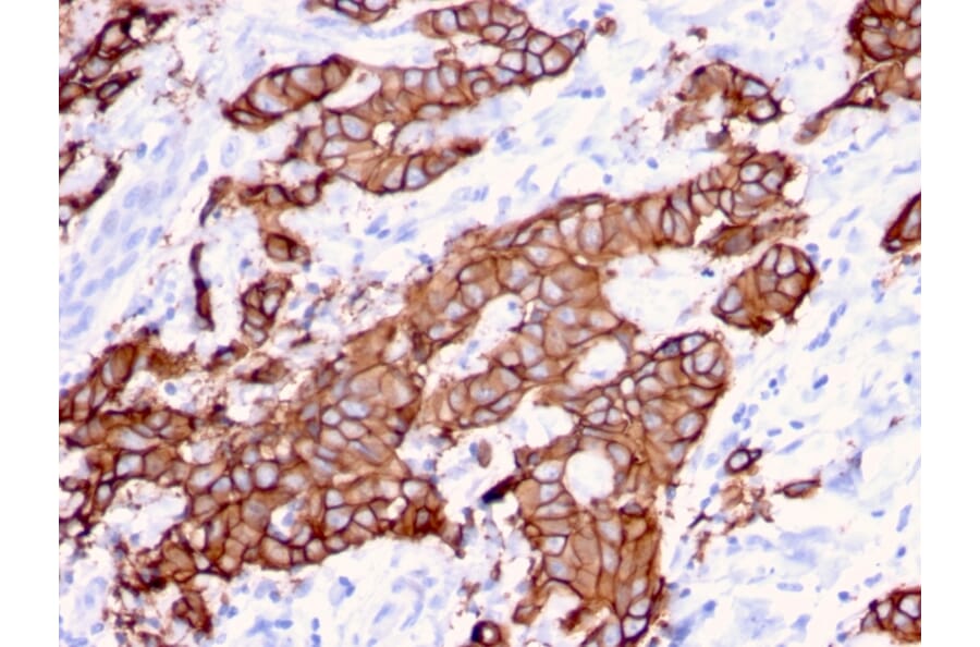 Immunohistochemistry - Anti-HER2 Antibody [ERBB2/3080] - BSA and Azide free (A251631) - Antibodies.com
