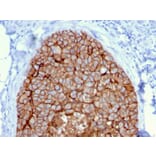 Immunohistochemistry - Anti-HER2 Antibody [ERBB2/3080] - BSA and Azide free (A251631) - Antibodies.com