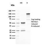 SDS-PAGE - Anti-HER2 Antibody [ERBB2/3080] - BSA and Azide free (A251631) - Antibodies.com