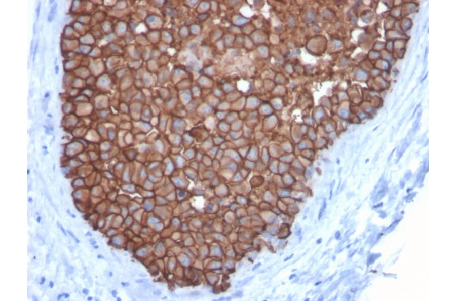 Immunohistochemistry - Anti-HER2 Antibody [ERBB2/3092] - BSA and Azide free (A251632) - Antibodies.com