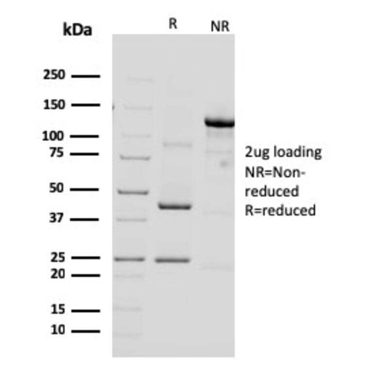 SDS-PAGE - Anti-HER2 Antibody [ERBB2/3092] - BSA and Azide free (A251632) - Antibodies.com
