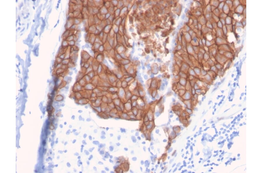 Immunohistochemistry - Anti-HER2 Antibody [ERBB2/3093] - BSA and Azide free (A251633) - Antibodies.com