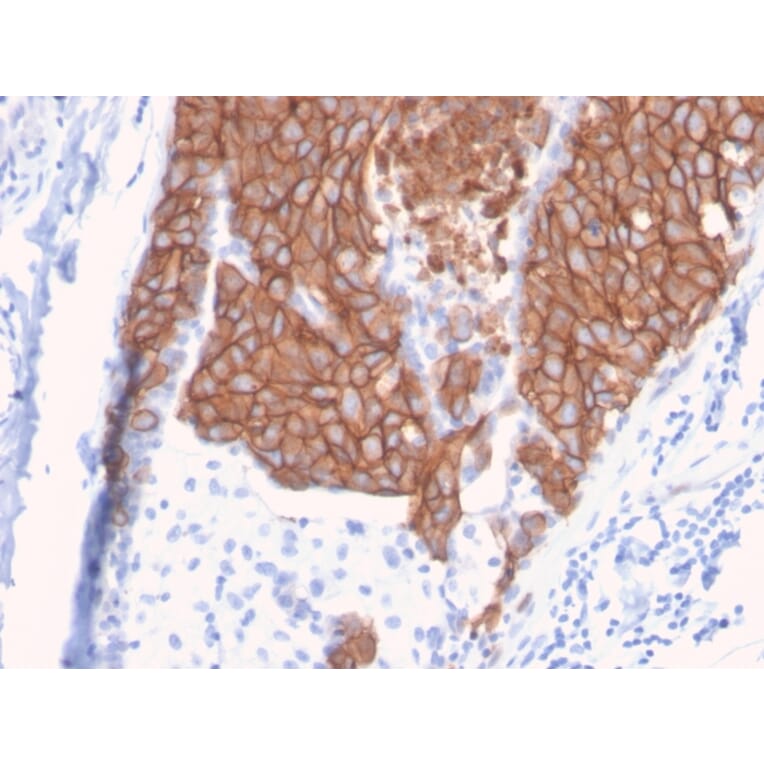 Immunohistochemistry - Anti-HER2 Antibody [ERBB2/3093] - BSA and Azide free (A251633) - Antibodies.com