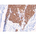 Immunohistochemistry - Anti-HER2 Antibody [ERBB2/3093] - BSA and Azide free (A251633) - Antibodies.com