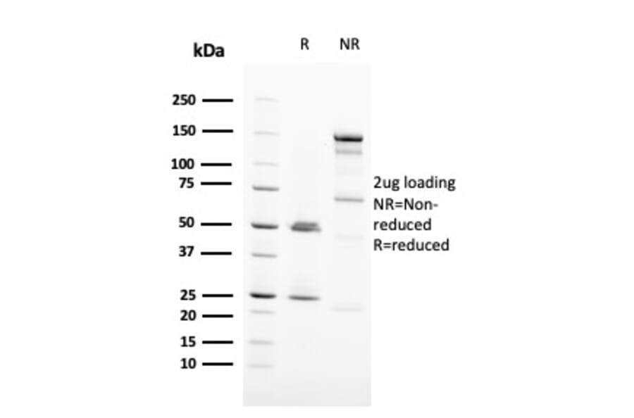 SDS-PAGE - Anti-HER2 Antibody [ERBB2/3093] - BSA and Azide free (A251633) - Antibodies.com
