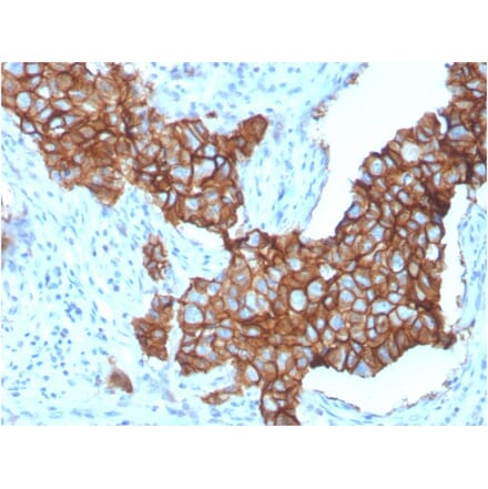 Immunohistochemistry - Anti-HER2 Antibody [ERBB2/3257] - BSA and Azide free (A251634) - Antibodies.com