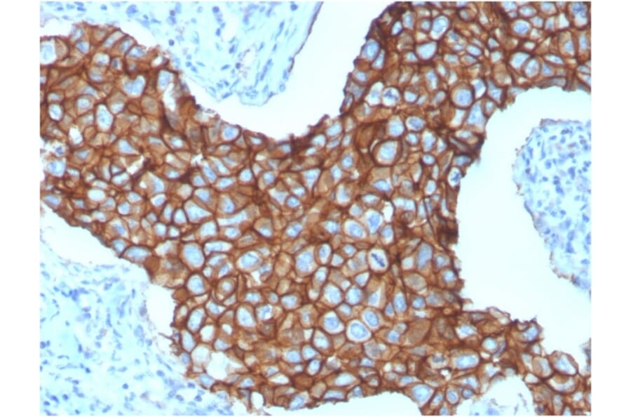 Immunohistochemistry - Anti-HER2 Antibody [ERBB2/3257] - BSA and Azide free (A251634) - Antibodies.com
