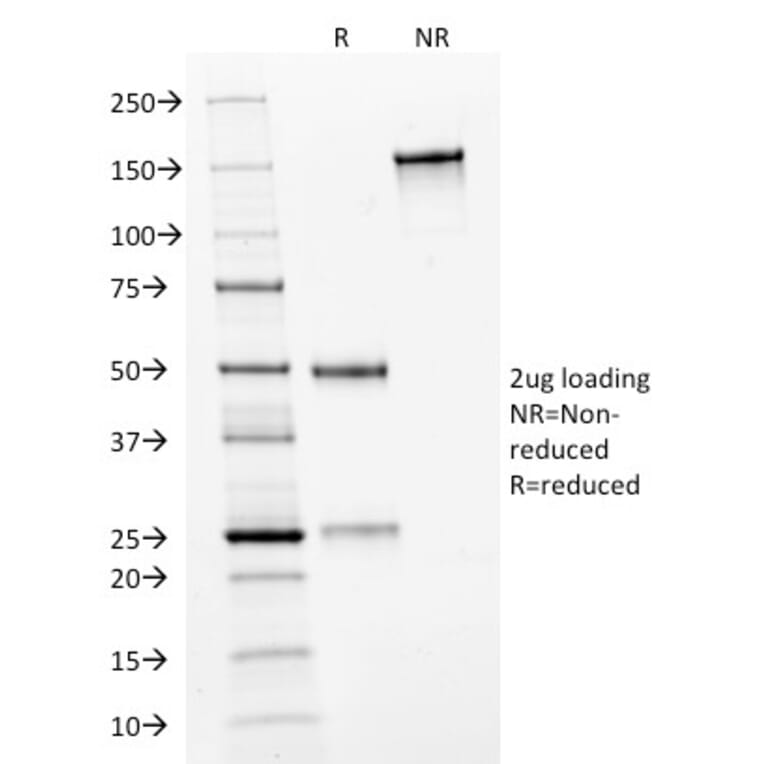 SDS-PAGE - Anti-HER2 Antibody [HRB2/282] - BSA and Azide free (A251636) - Antibodies.com