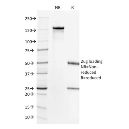 SDS-PAGE - Anti-HER2 Antibody [HRB2/718] - BSA and Azide free (A251637) - Antibodies.com