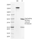 SDS-PAGE - Anti-HER2 Antibody [HRB2/718] - BSA and Azide free (A251637) - Antibodies.com