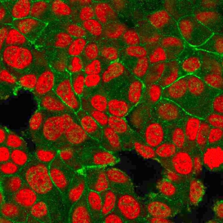 Immunofluorescence - Anti-HER2 Antibody [HRB2/718] - BSA and Azide free (A251637) - Antibodies.com