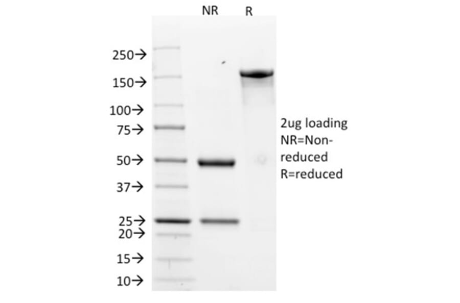SDS-PAGE - Anti-HER2 Antibody [ERB2/776] - BSA and Azide free (A251638) - Antibodies.com
