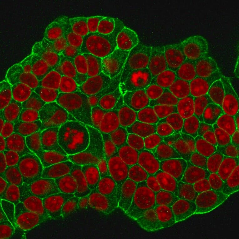 Immunofluorescence - Anti-HER2 Antibody [ERB2/776] - BSA and Azide free (A251638) - Antibodies.com